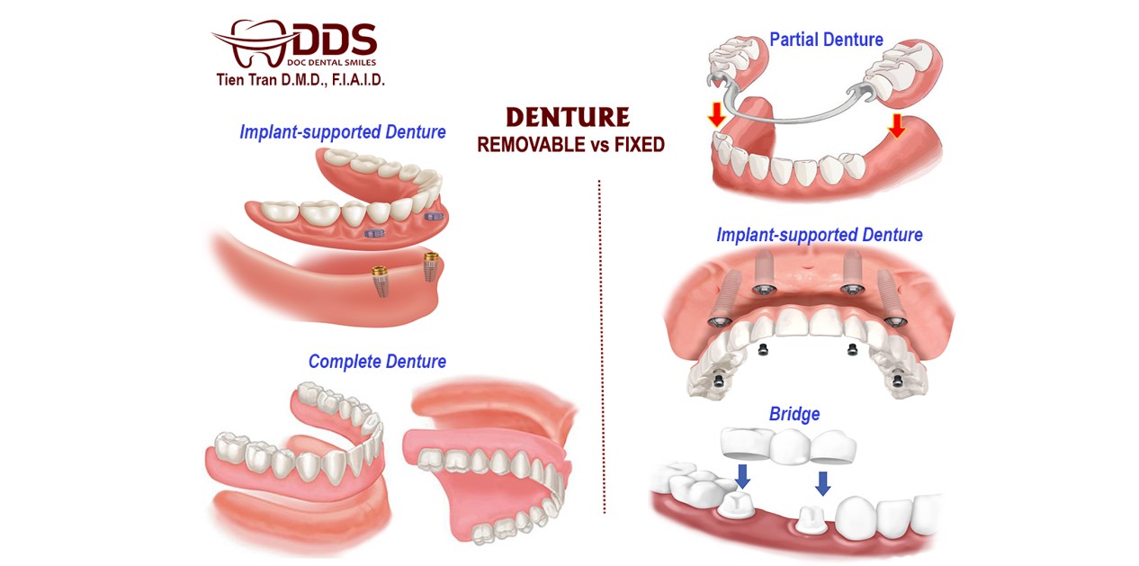 Denture