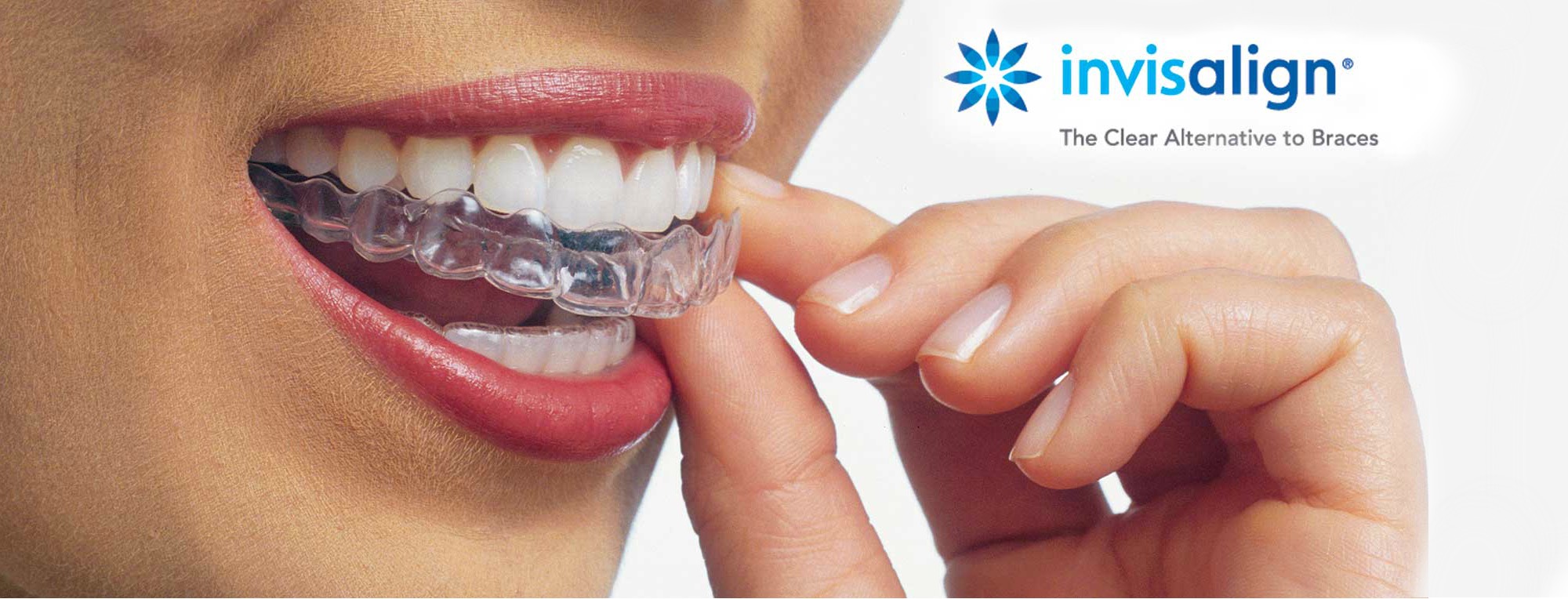 Invisalign Background 1 Copy